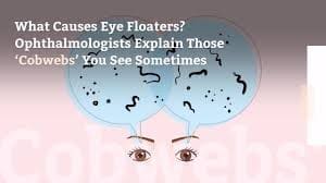 Floaters infographic
