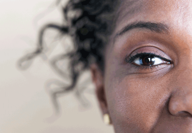 Woman showing her right eye twitching Maple Grove Eye Doctors at pearle vision